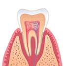 歯周病治療 